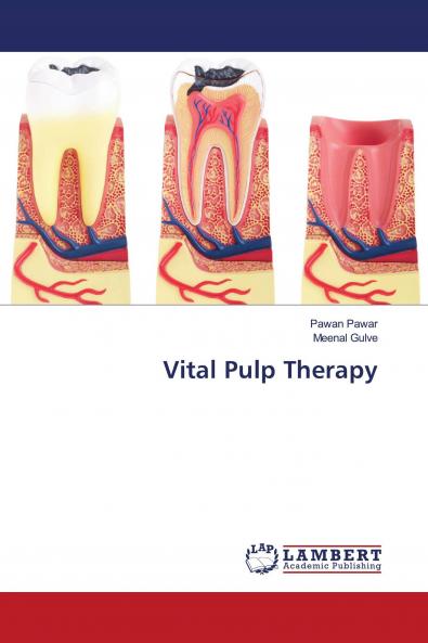 Vital Pulp Therapy