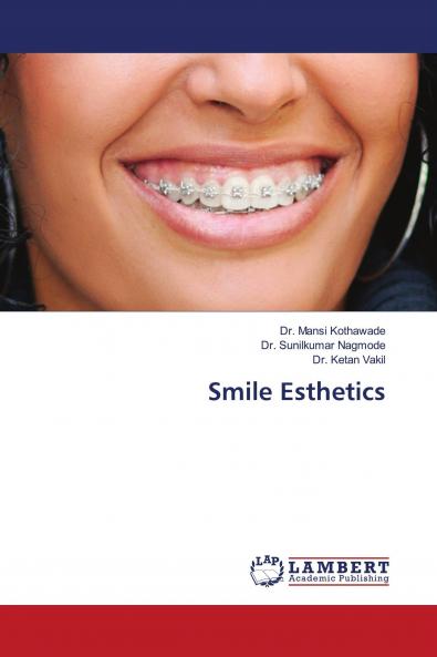 Smile Esthetics