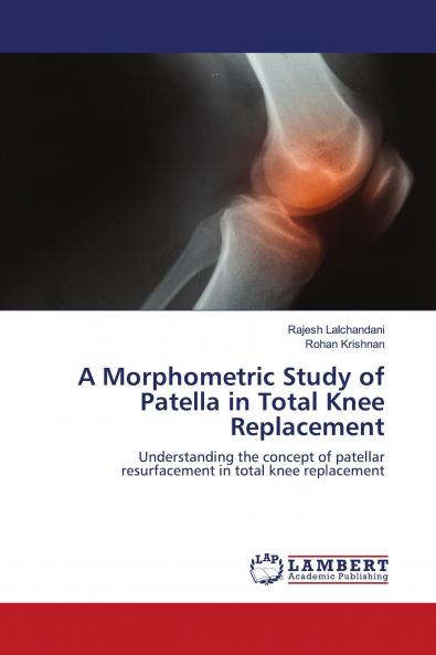 A Morphometric Study of Patella in Total Knee Replacement