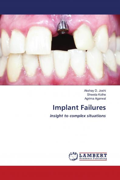 Implant Failures