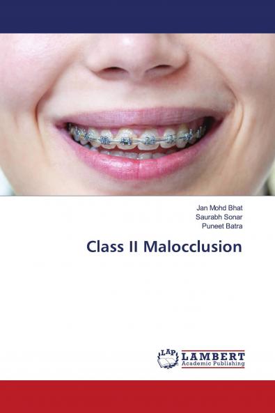 Class II Malocclusion
