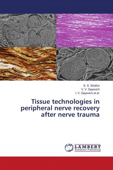 Tissue technologies in peripheral nerve recovery after nerve trauma