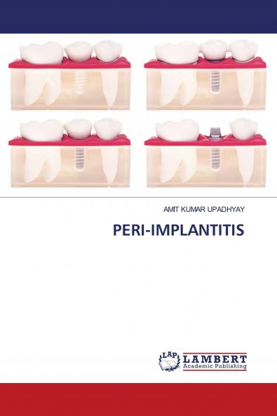 PERI-IMPLANTITIS