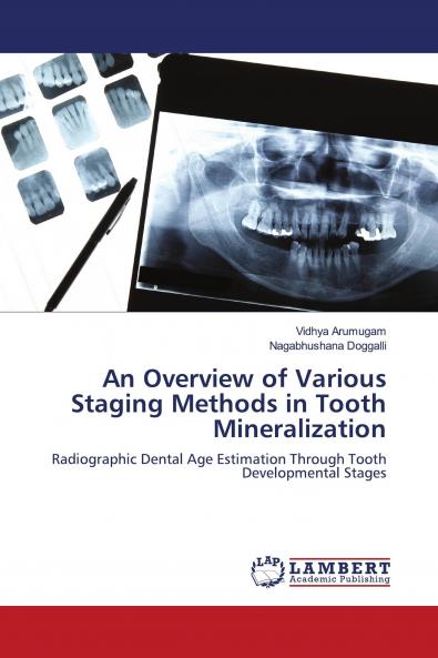 An Overview of Various Staging Methods in Tooth Mineralization