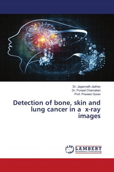 Detection of bone skin and lung cancer in a x-ray images
