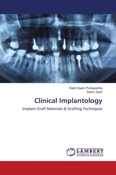 Clinical Implantology