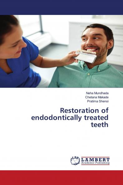 Restoration of endodontically treated teeth