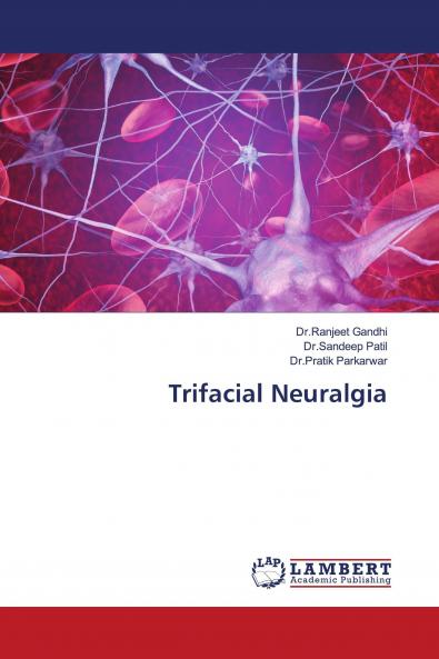 Trifacial Neuralgia