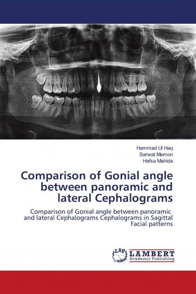 Comparison of Gonial angle between panoramic and lateral Cephalograms