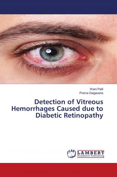 Detection of Vitreous Hemorrhages Caused due to Diabetic Retinopathy