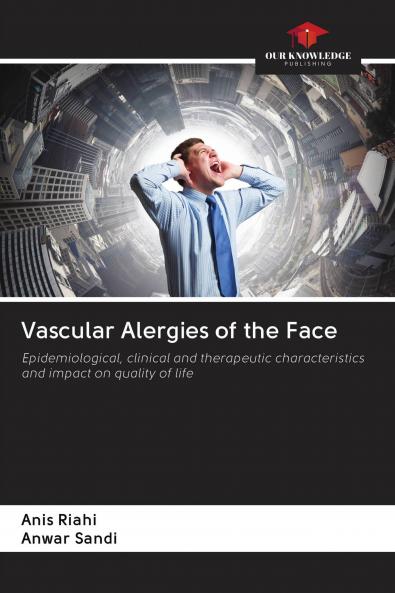 Vascular Alergies of the Face