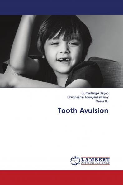 Tooth Avulsion