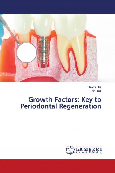 Growth Factors: Key to Periodontal Regeneration