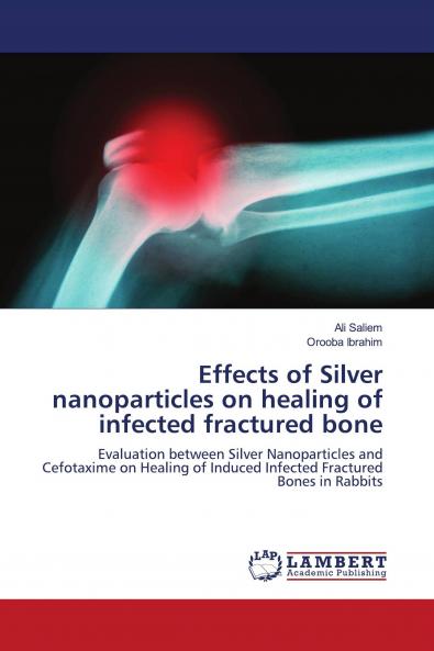Effects of Silver nanoparticles on healing of infected fractured bone