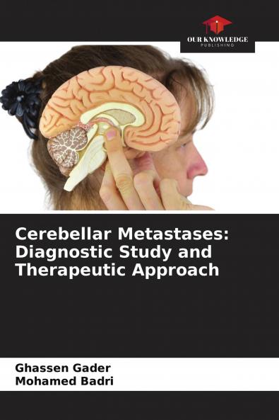 Cerebellar Metastases