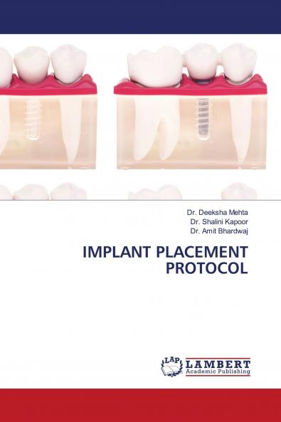 IMPLANT PLACEMENT PROTOCOL