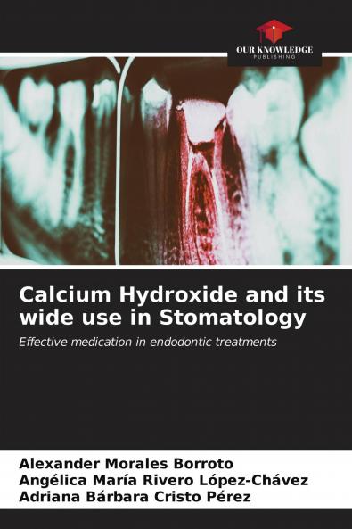 Calcium Hydroxide and its wide use in Stomatology