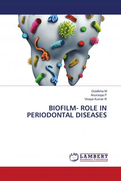 BIOFILM- ROLE IN PERIODONTAL DISEASES