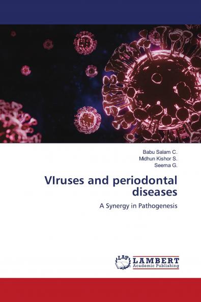 VIruses and periodontal diseases