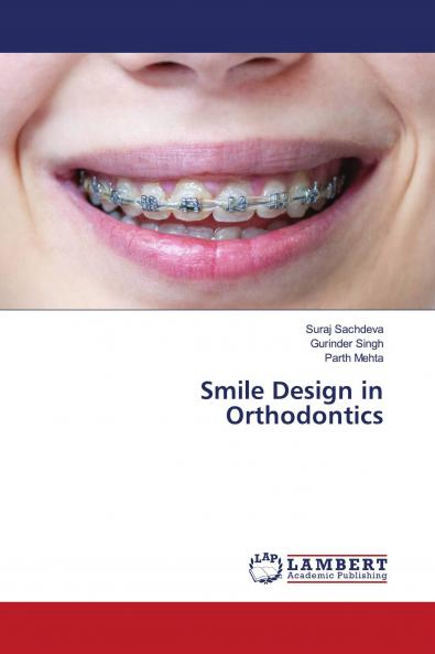Smile Design in Orthodontics