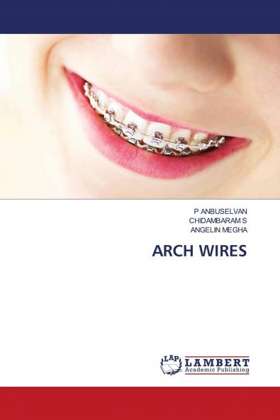 ARCH WIRES