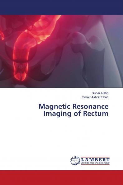 Magnetic Resonance Imaging of Rectum