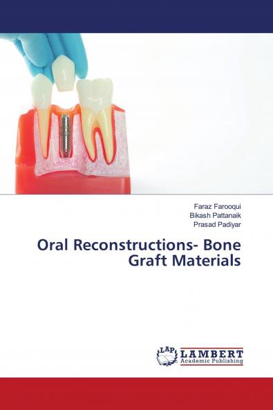 Oral Reconstructions- Bone Graft Materials