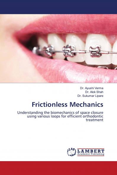 Frictionless Mechanics