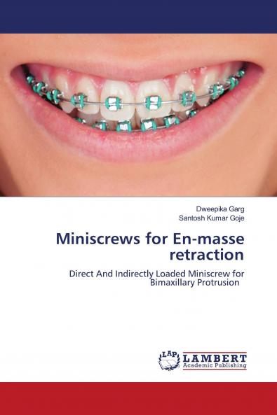 Miniscrews for En-masse retraction