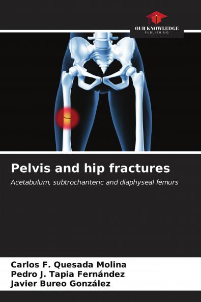 Pelvis and hip fractures
