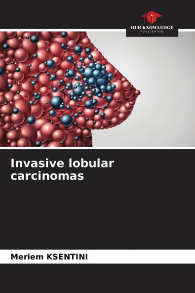 Invasive lobular carcinomas