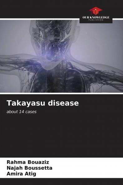 Takayasu disease