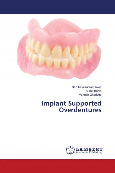 Implant Supported Overdentures