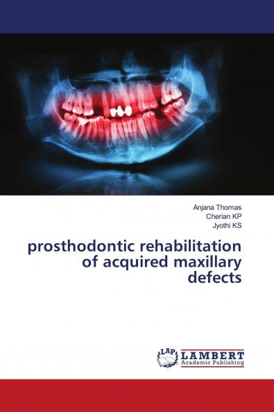prosthodontic rehabilitation of acquired maxillary defects