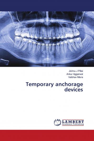 Temporary anchorage devices