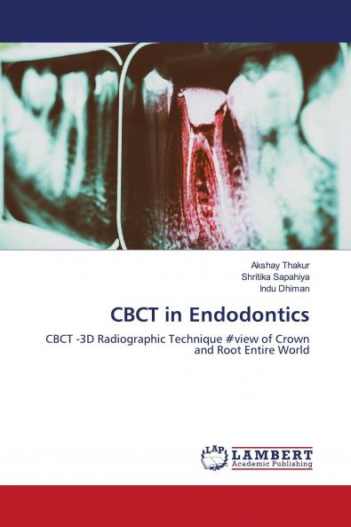 CBCT in Endodontics