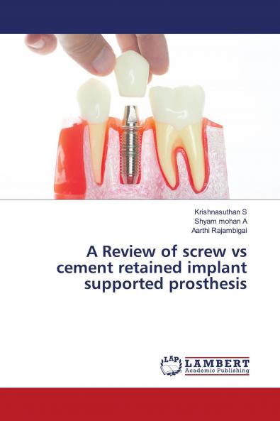A Review of screw vs cement retained implant supported prosthesis