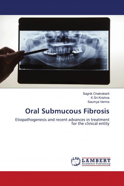 Oral Submucous Fibrosis