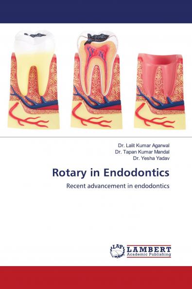 Rotary in Endodontics