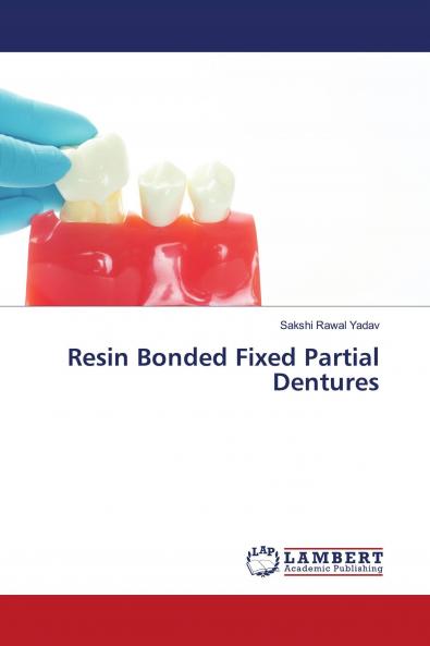Resin Bonded Fixed Partial Dentures