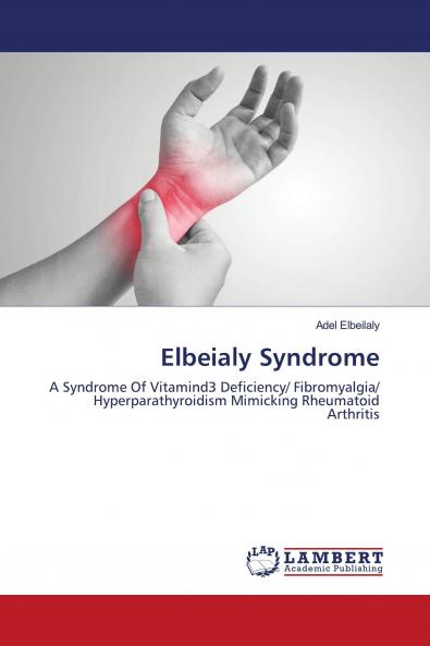 Elbeialy Syndrome