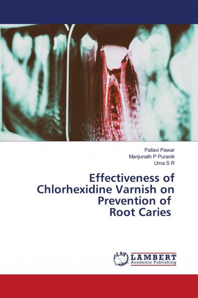 Effectiveness of Chlorhexidine Varnish on Prevention of Root Caries