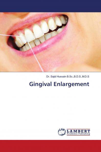 Gingival Enlargement