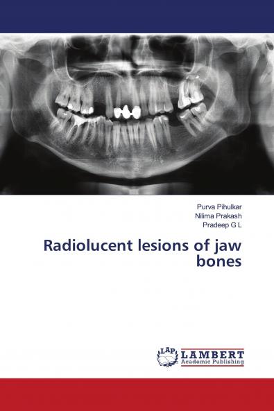 Radiolucent lesions of jaw bones
