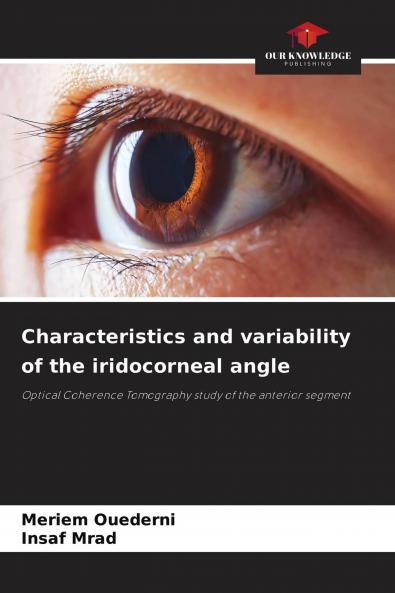 Characteristics and variability of the iridocorneal angle