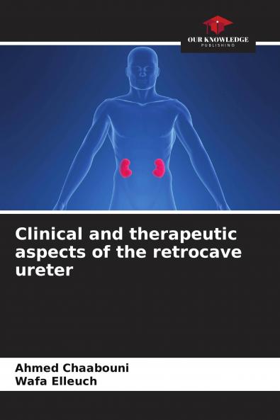 Clinical and therapeutic aspects of the retrocave ureter