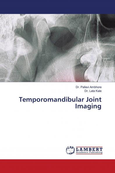 Temporomandibular Joint Imaging