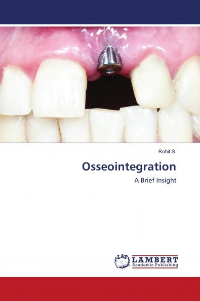 Osseointegration
