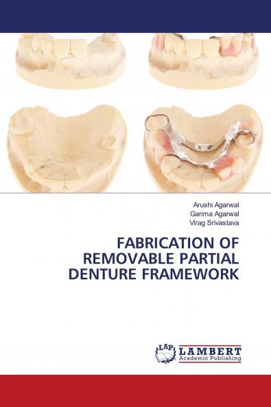 FABRICATION OF REMOVABLE PARTIAL DENTURE FRAMEWORK