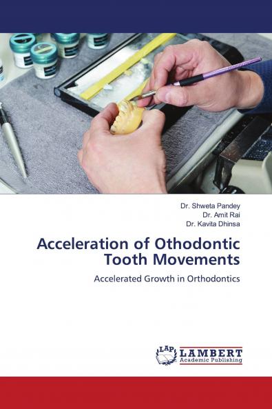 Acceleration of Othodontic Tooth Movements